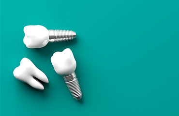 New Implant Dentistry