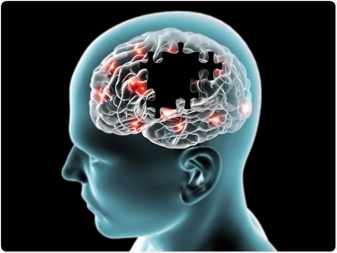 La maladie d’Alzheimer : accompagner sans oublier